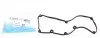 Прокладка кришки клапанів VW Caddy III/IV 1.6TDI 10- 71-40484-00