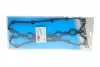 Прокладка крышки клапанов VW Jetta 2.5 FSI 04-11 71-37571-00