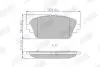 572428J Колодки тормозные (передние) Honda Accord VI 98-02/Nissan Primera P12 02-08 JURID підбір по vin на Brocar