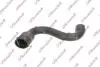 KAUTEK AUDI патрубок радіатора A6 C5 (4B2) 1.8 97-05 AU-RH021